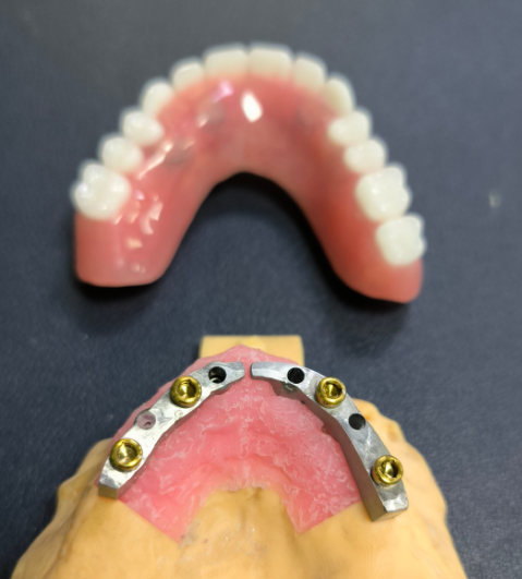 Lokátor és Titanium Dental Bar