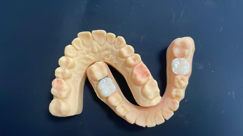 Mi az a váll széle?