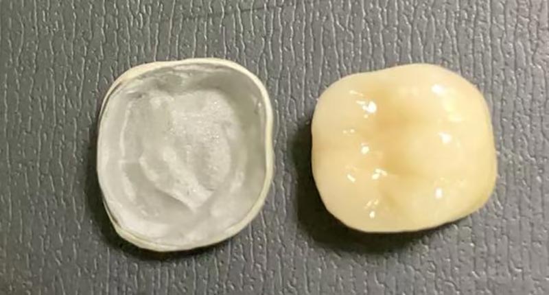 WM DENTAL LAB – A vezető kínai fogászati ​​labor