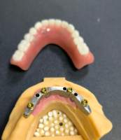 Kereső és fogorvosi bár